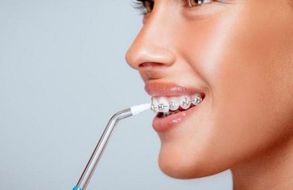 Іригатор – ефективний засіб гігієни порожнини рота.