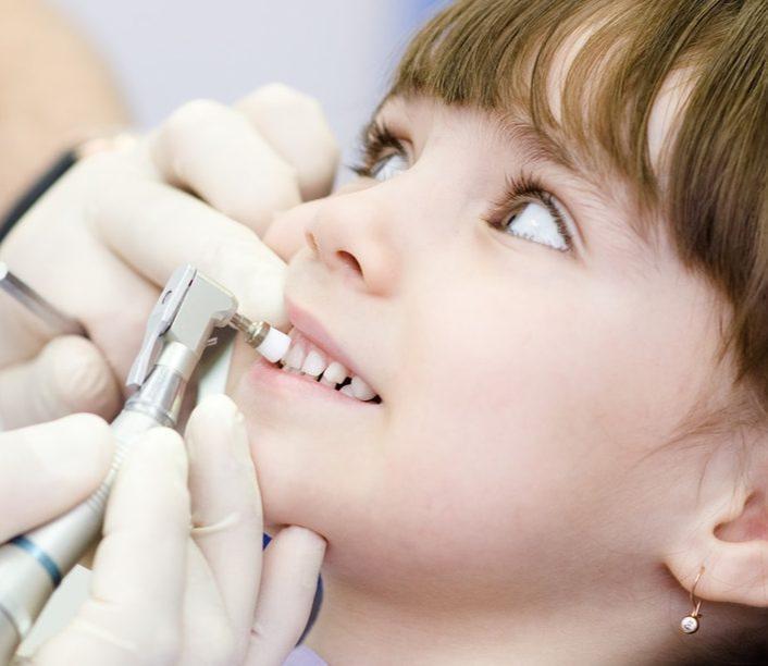 Роль іригатора у гігієні брекетів у підлітків