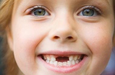 Вплив стану зубів на організм