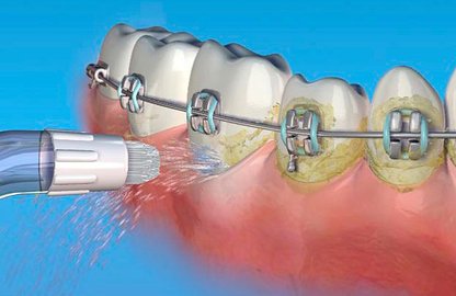 Рідина для іригації