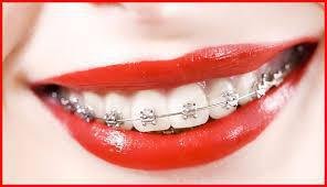 Гігієна ротової порожнини: розвиток захворювань